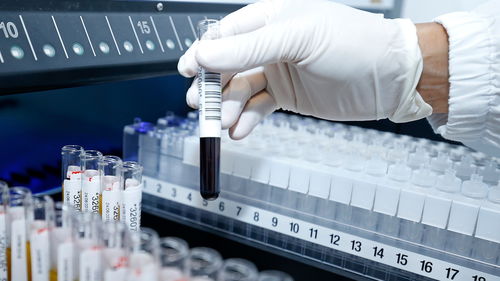 科學(xué)技術(shù)發(fā)展基金資助26項新型冠狀病毒感染科研項目助力技術(shù)開發(fā)